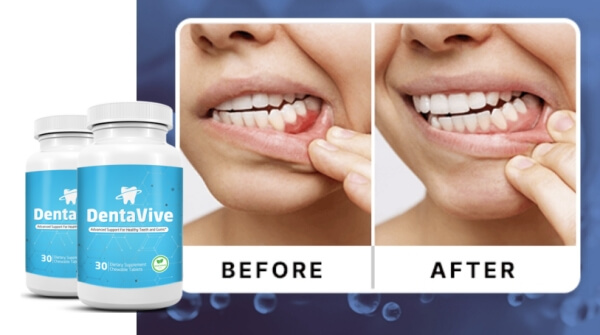 Dentaviven käyttö Dentaviven käyttö